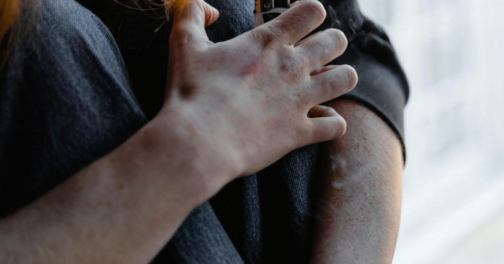 March Blogs 2026 41 | Nashville Mental Health